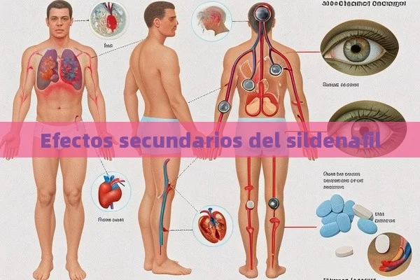 Efectos secundarios del sildenafil - Viagra:¿Cuál Elegir?